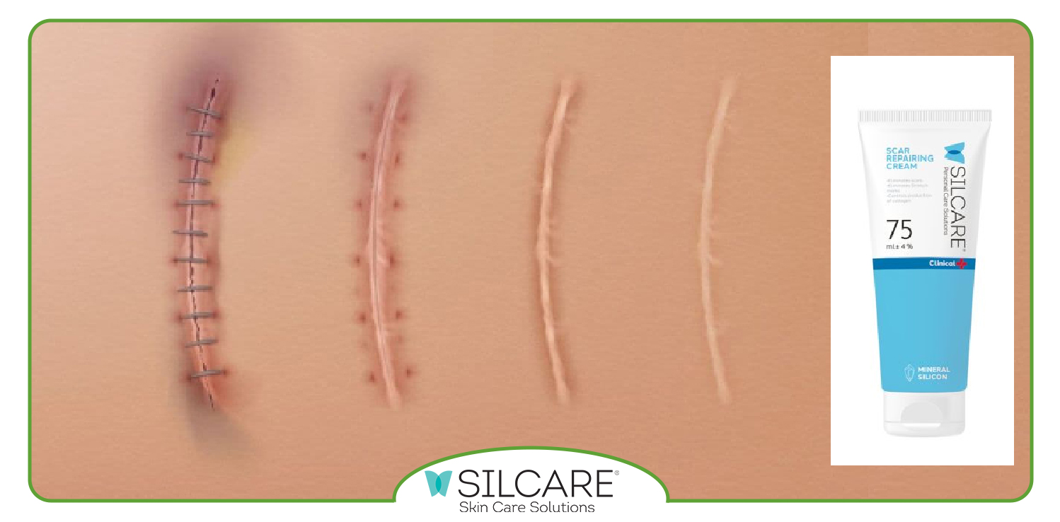 سوالات متداول در رابطه با کرم ترمیم کننده