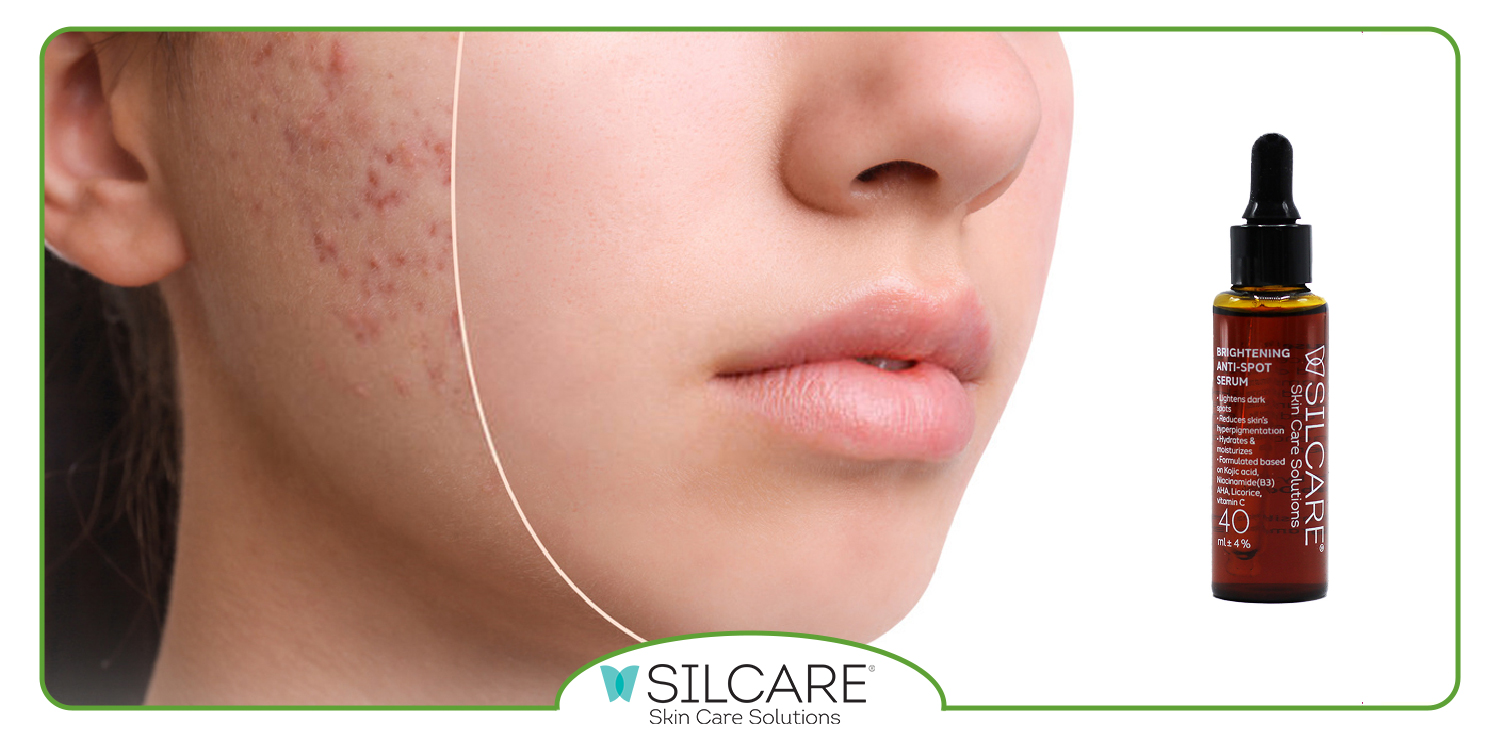 طرز استفاده از سرم ضد لک سیلکر