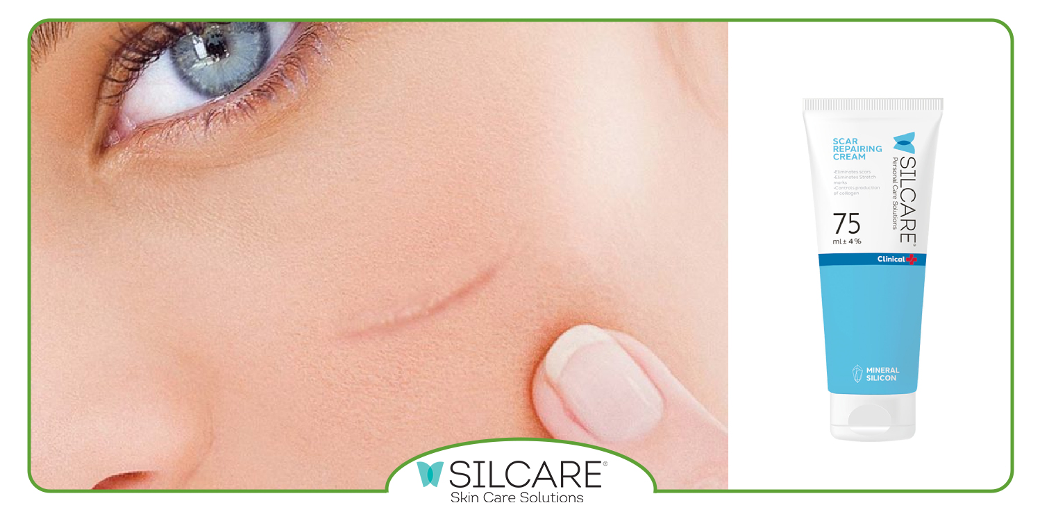 مزایای کرم Silcare چیست؟