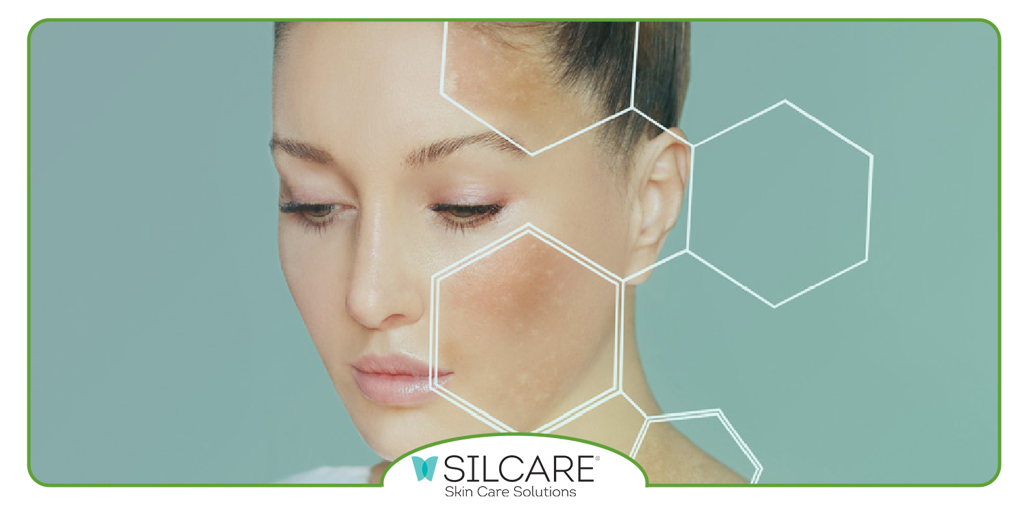 چرا استفاده از سرم ضد لک اهمیت بالایی دارد؟