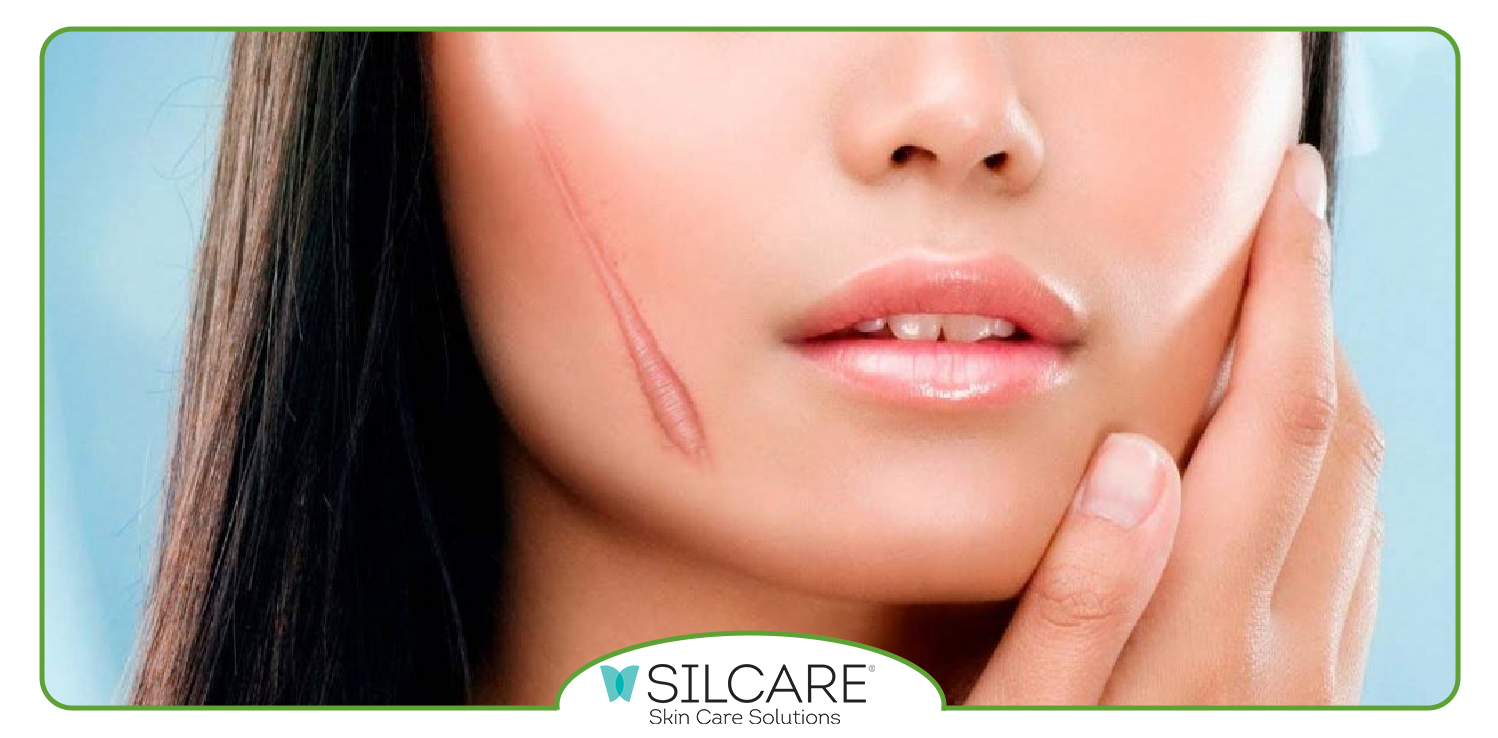 کرم سیلکر را از کجا بخریم؟