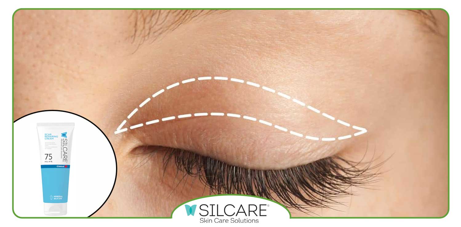 انواع ترمیم کننده سیلکر