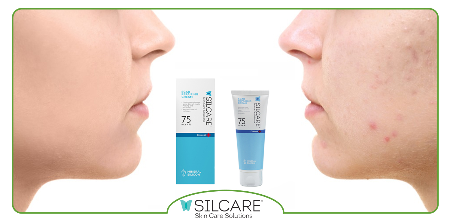 بهترین ترمیم کننده برای جای جوش