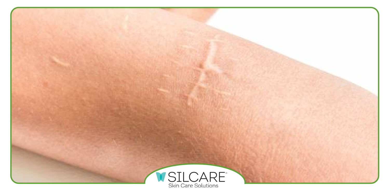 بهترین پماد برای زخم باز