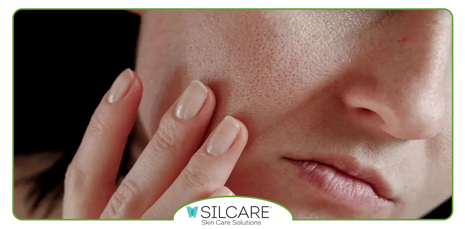 بهترین کرم مرطوب کننده پوست خشک