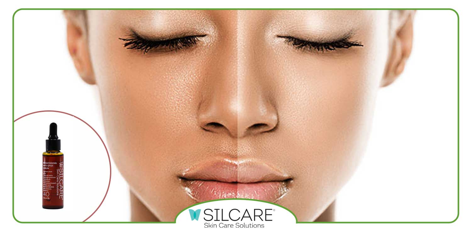 سفید شدن پوست صورت در یک روز