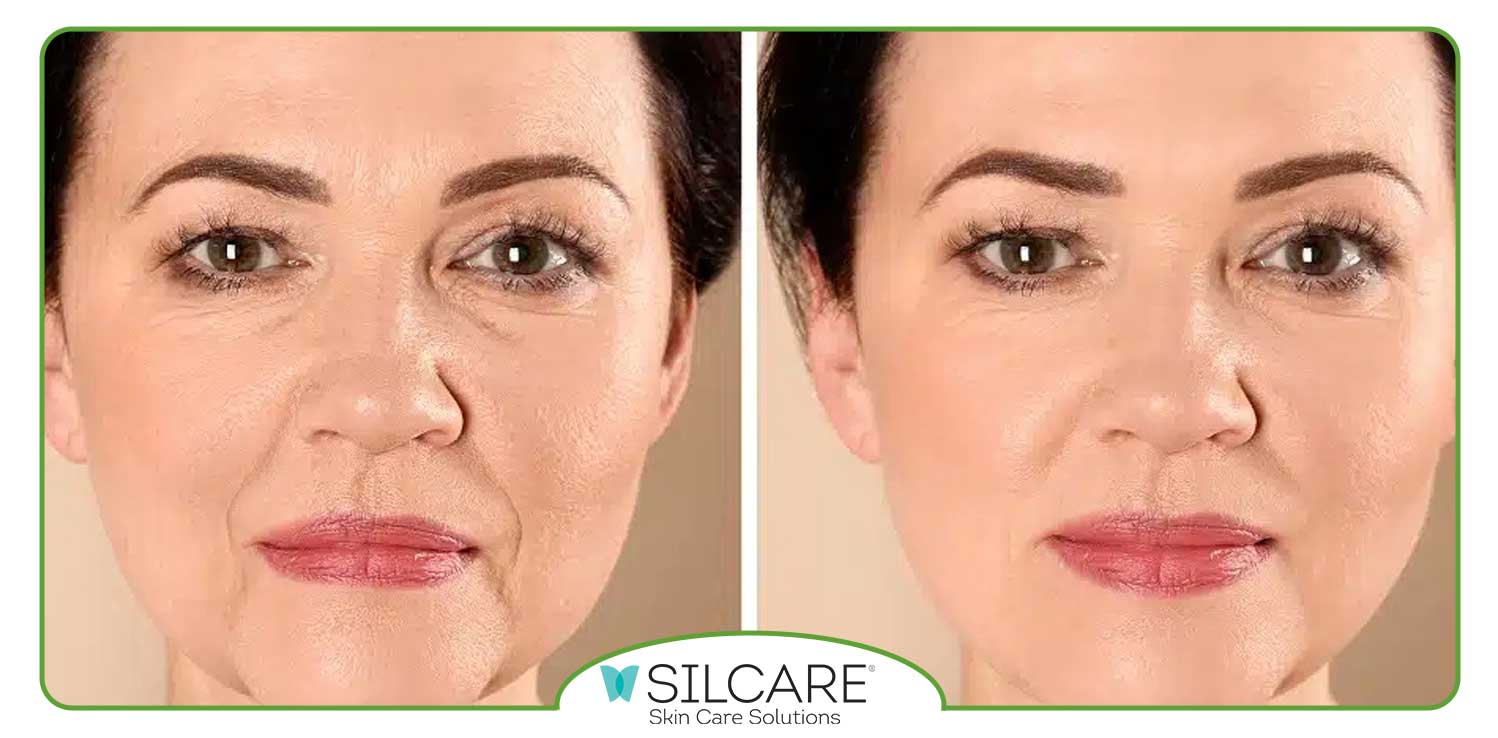 فواید استفاده از سرم های سفت ‌کننده ‌پوست