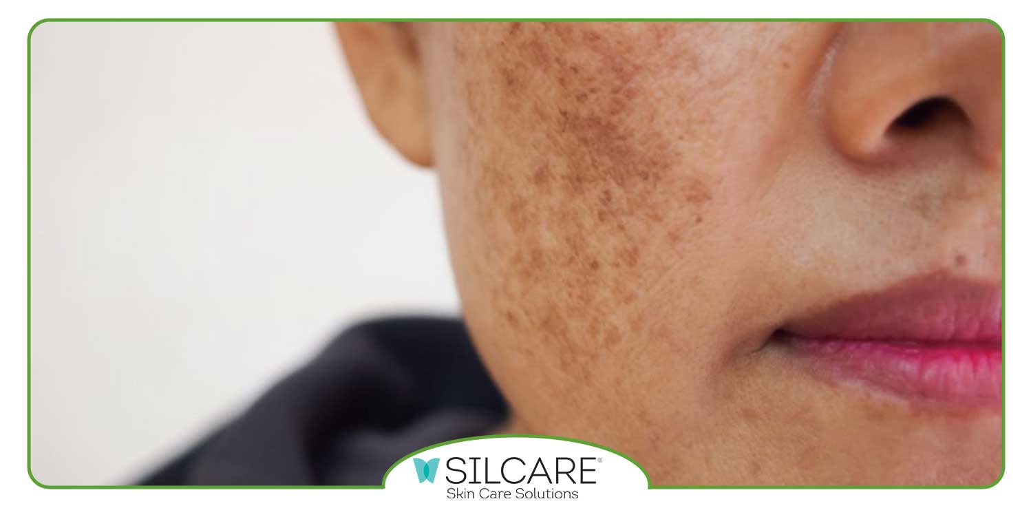 ویژگی های سرم روشن کننده پوست صورت