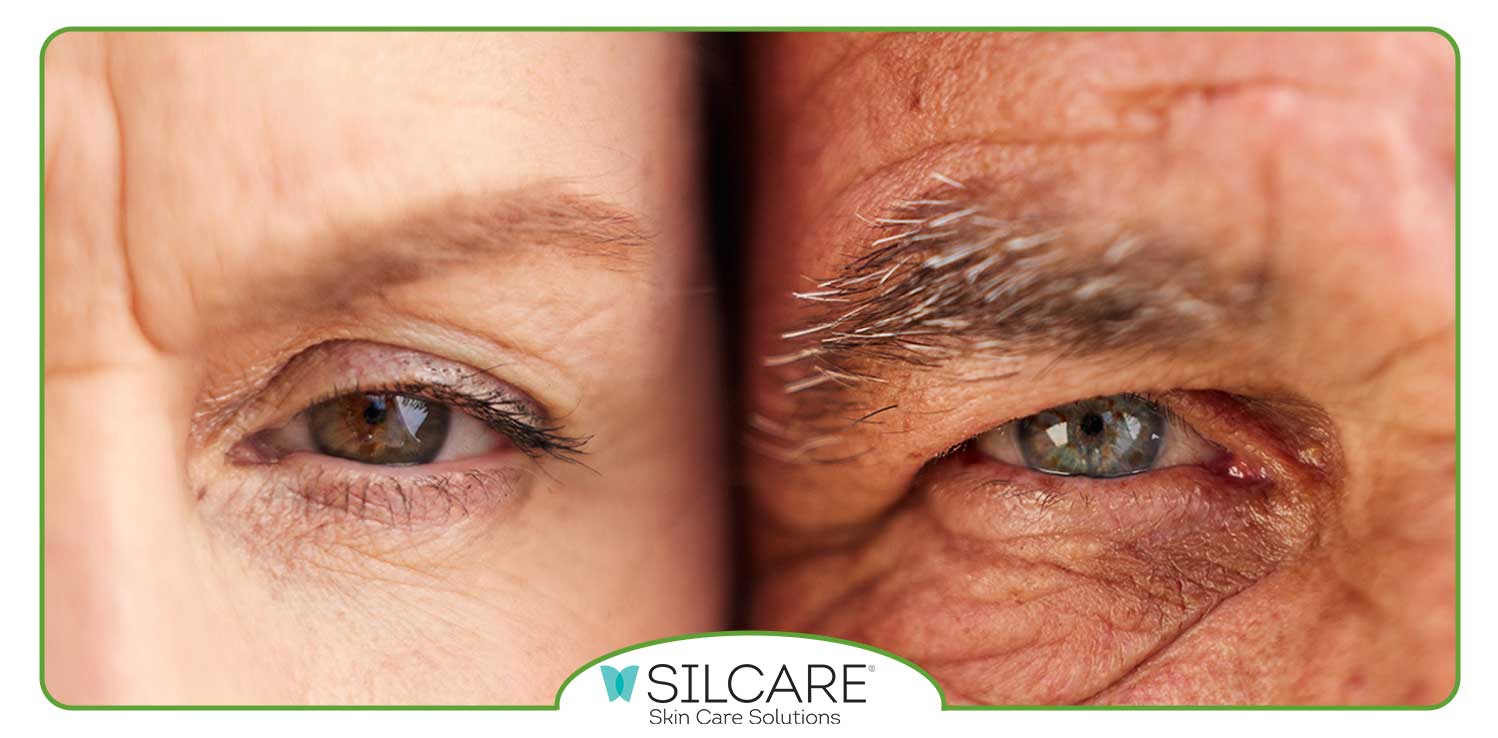 کرم-های-دارای-e-برای-چروک-پیشانی