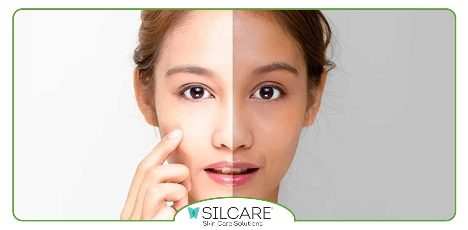 آیا تغییر رنگ پوست از سبزه به سفید واقعا امکان پذیر است؟