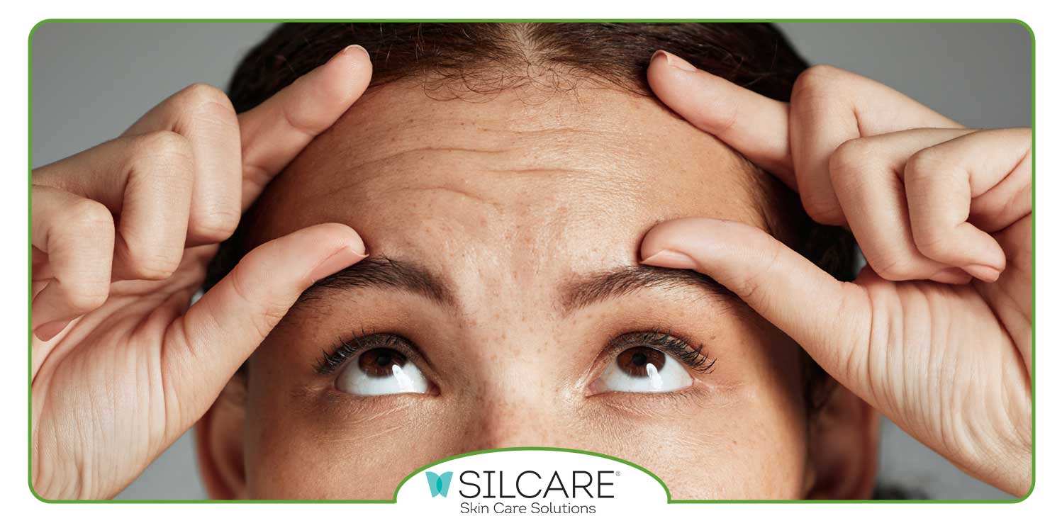 برای چروک پیشانی چه کرمی خوبه؟