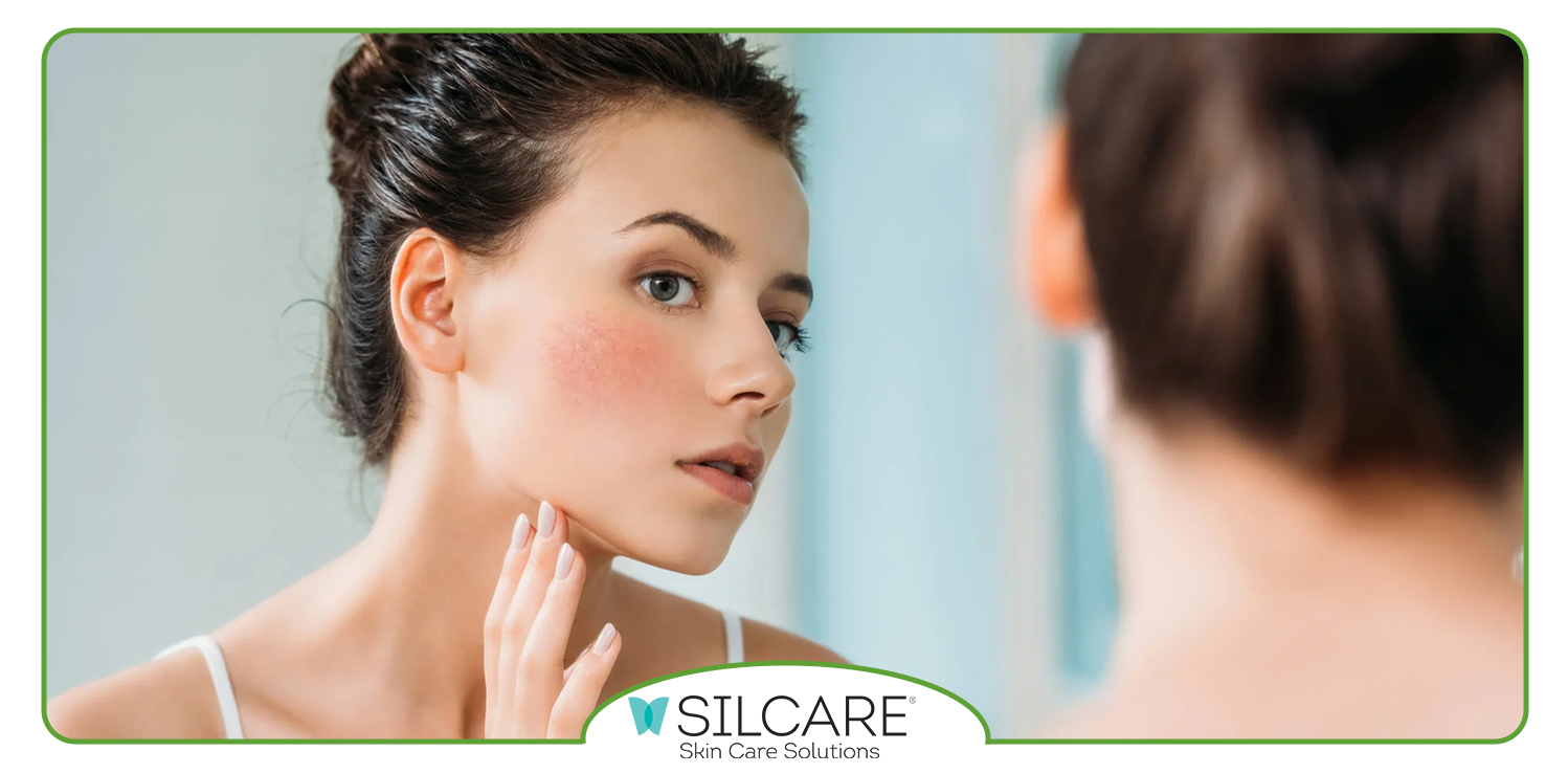 بهترین کرم ایرانی برای پوست خشک