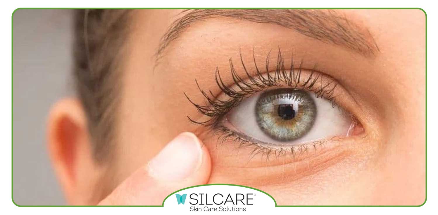 بهترین-کرم-رفع-پف-و-تیرگی-زیر-چشم