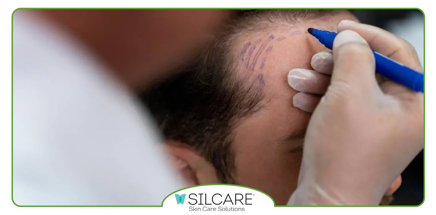 تاثیر گذاری اسپری آب سیلکر بر روی ابروهای کاشت شده به چه صورت است؟