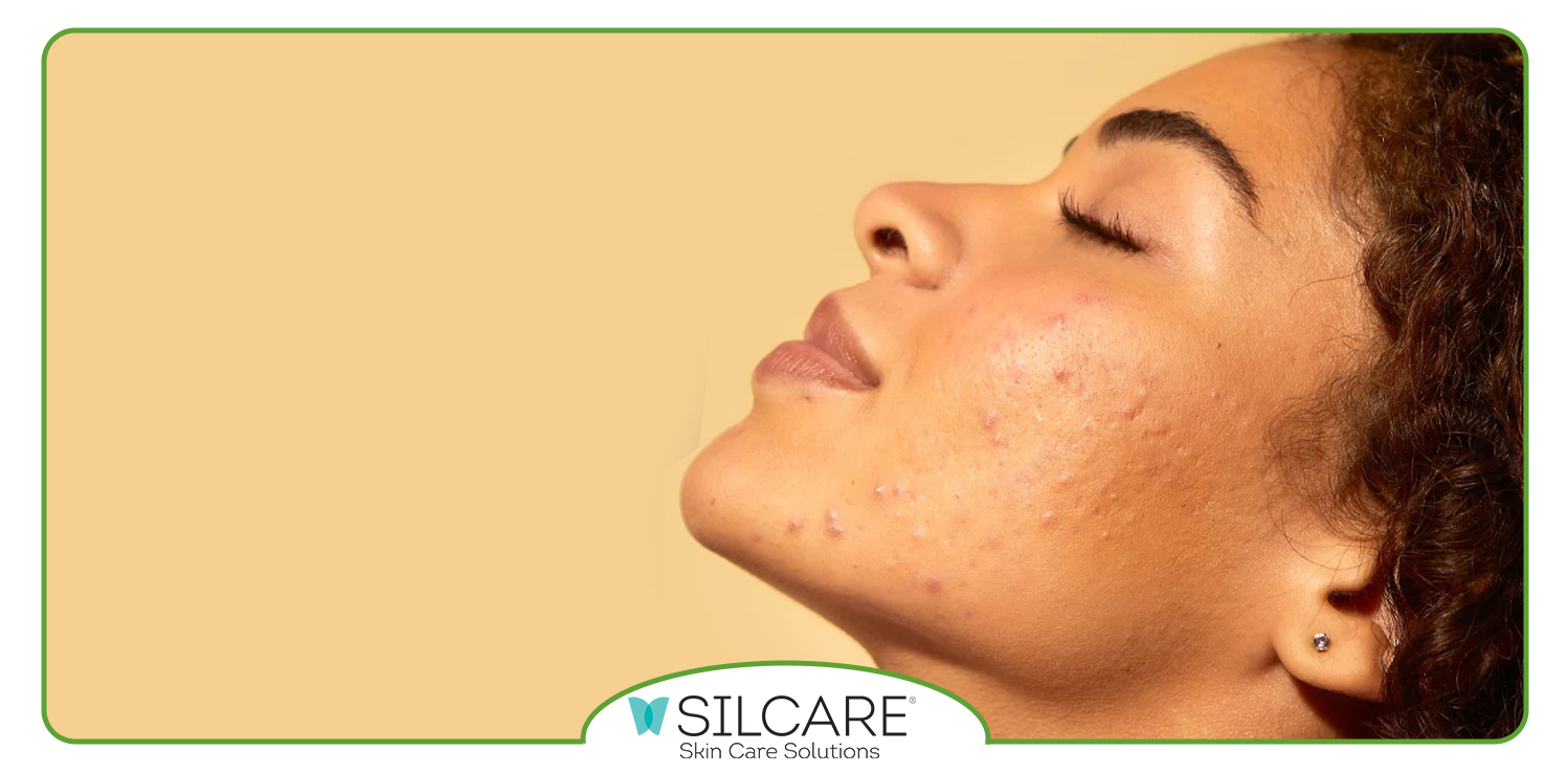 تونر پوست چرب سیلکر را از کجا بخریم؟