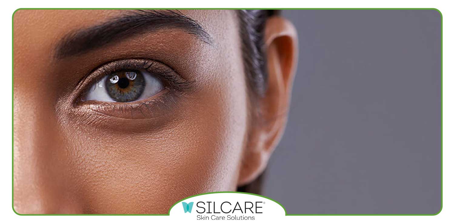 رابطه-پف-زیر-چشم-و-کبد