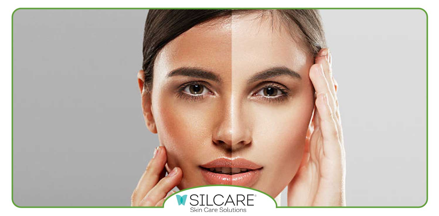 راهکارهای خانگی و طبیعی برای روشن کردن پوست