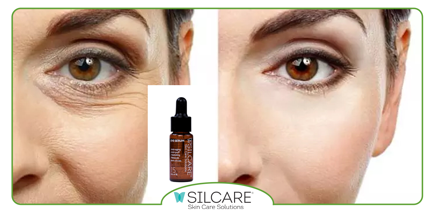 سرم های دور چشم چه ویژگی هایی دارند؟