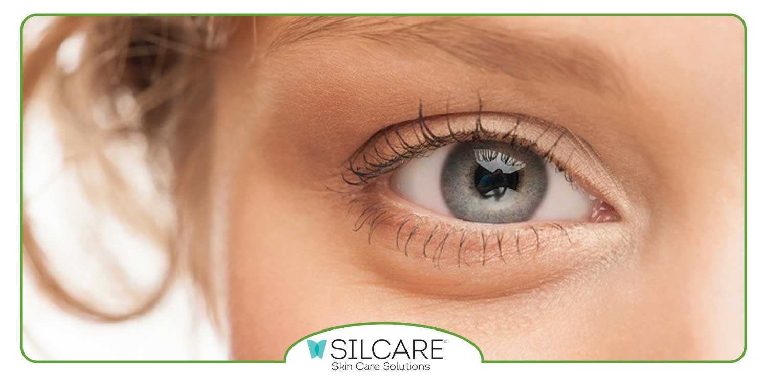 علت-پف-زیر-چشم-در-چیست؟