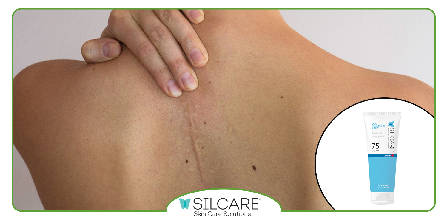 عوارض استفاده از کرم ترمیم کننده جای بخیه چیست؟