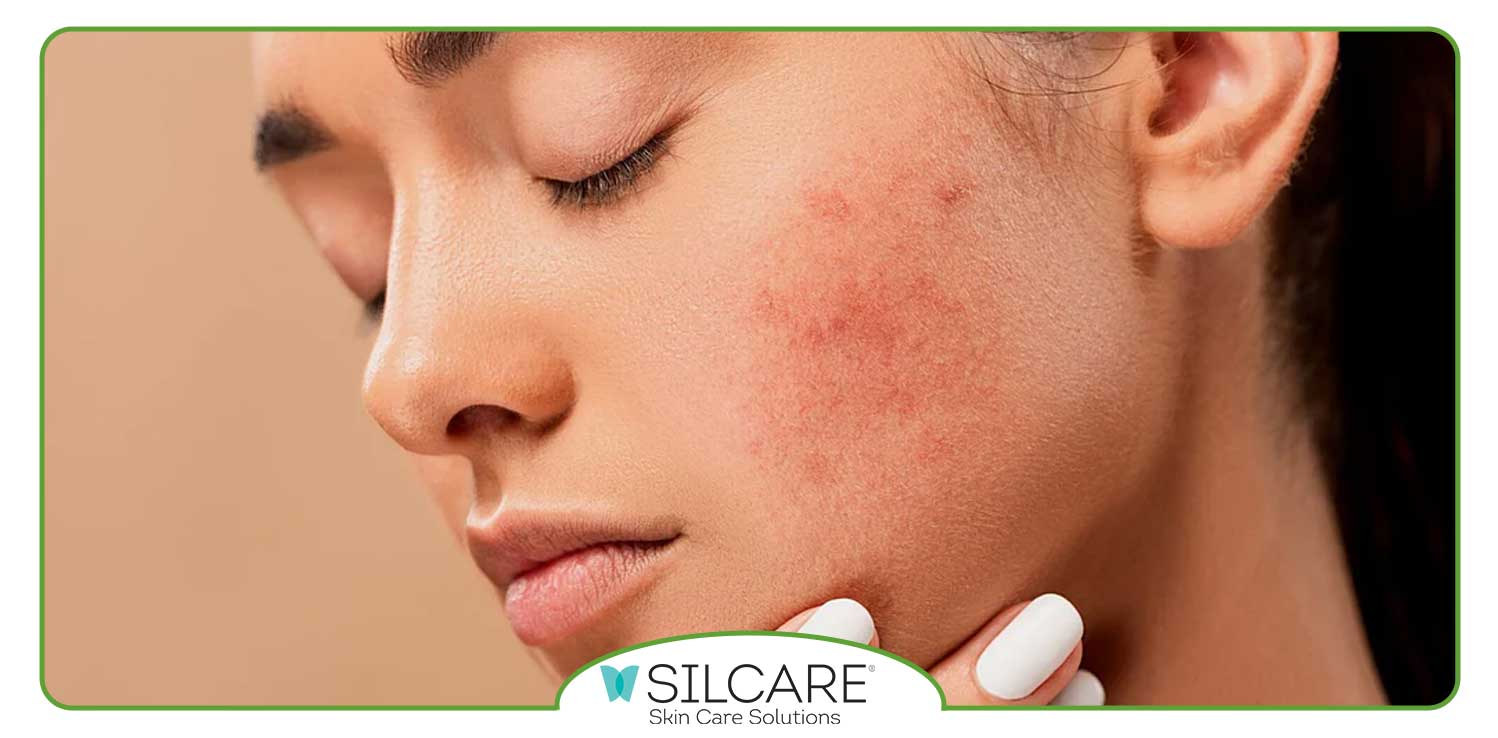 نکات مهم هنگام انتخاب کرم ترمیم کننده مناسب انواع پوست