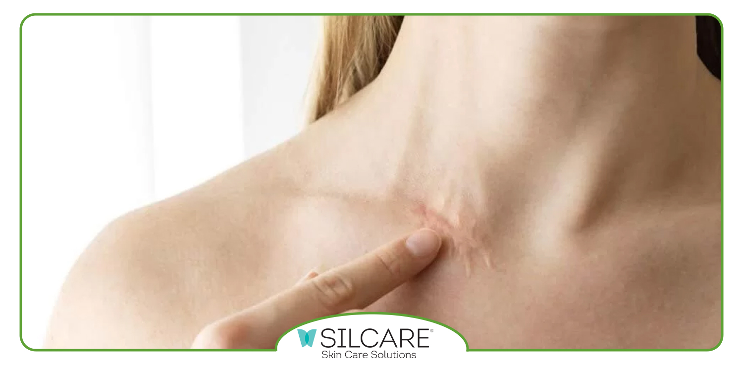 کرم ترمیم کننده سیلکر را از کجا بخریم؟