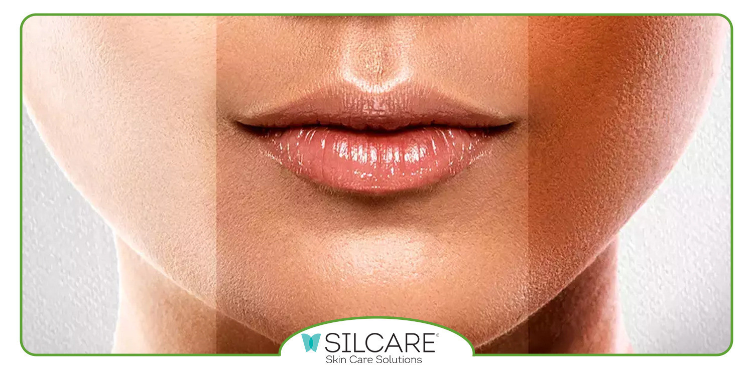 یک سرم روشن کننده باید چه ترکیباتی داشته باشد؟