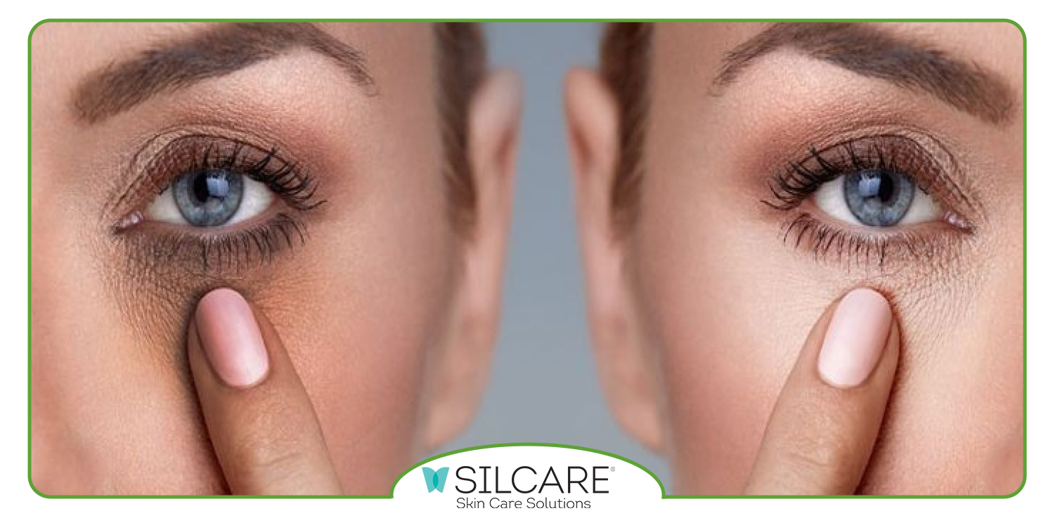 بهترین سرم دور چشم برای رفع سیاهی و گودی چشم