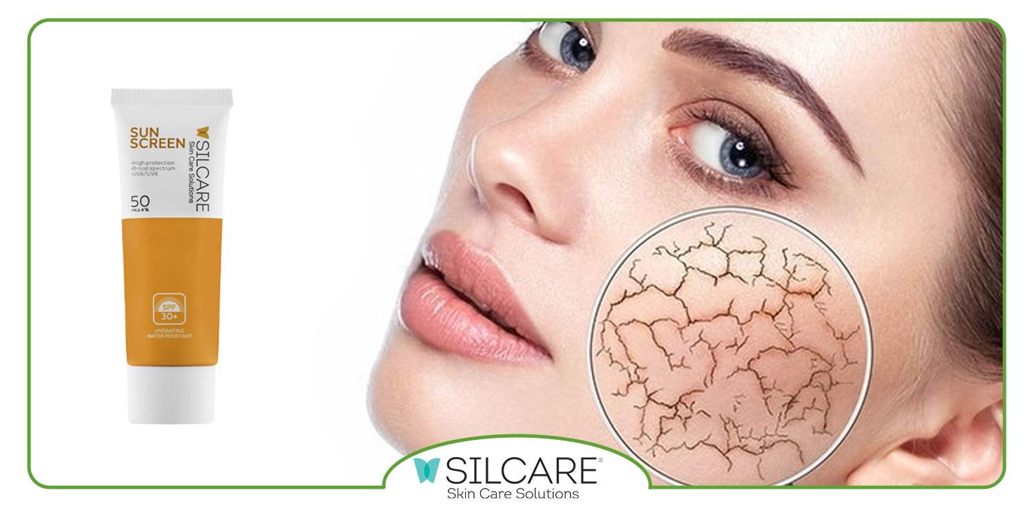 بهترین کرم ضد آفتاب برای پوست خشک و جوشدار