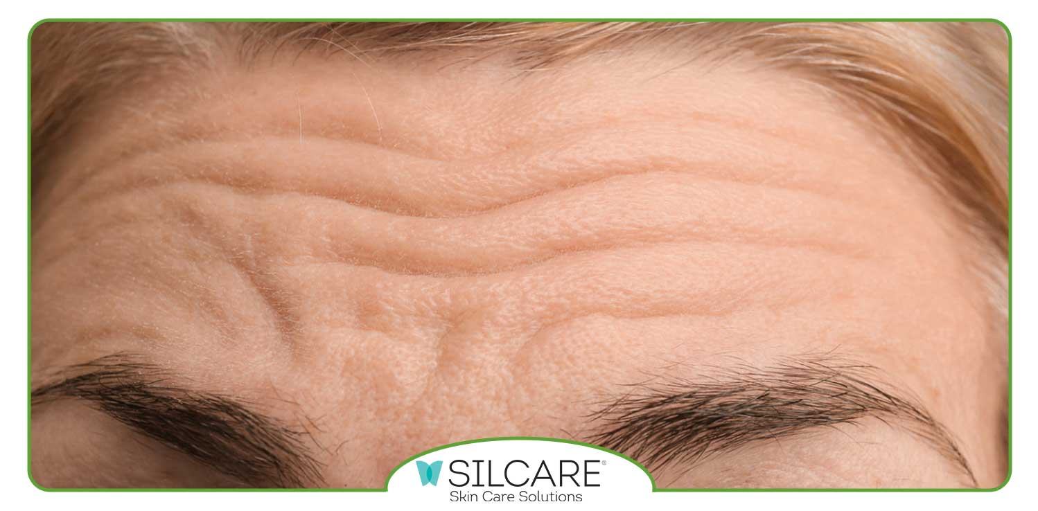 بهترین کرم ضد چروک برای پیشانی چیه؟