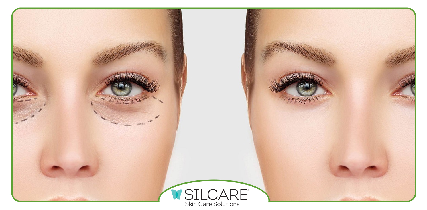 ترکیبات سرم دور چشم سیلکر