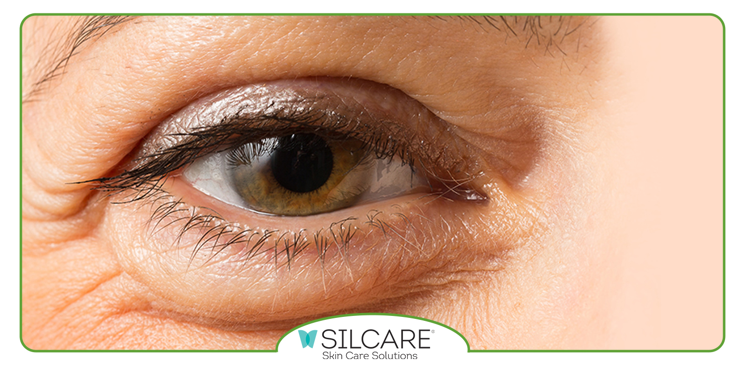 مزایای استفاده از سرم دور چشم سیلکر