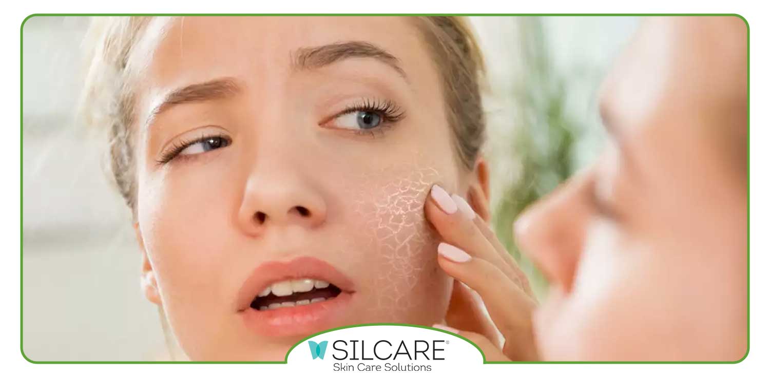 برای خشکی بیش از حد پوست چه کنیم؟