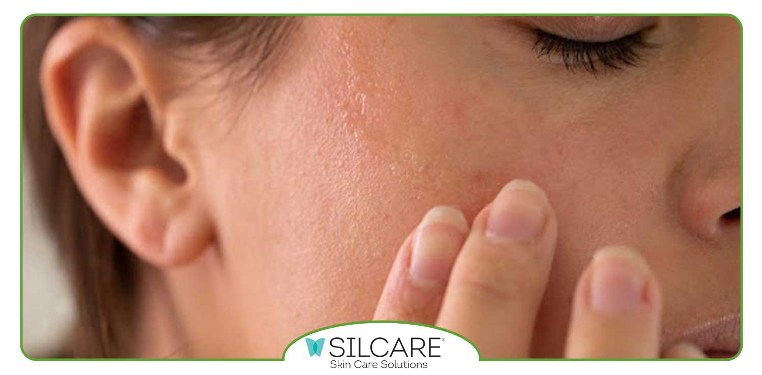 علل شایع خشکی پوست شامل چه مواردی است؟