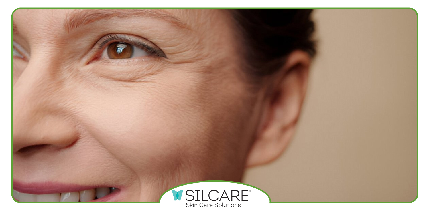 آیا وازلین برای چروک دور لب مناسب است؟