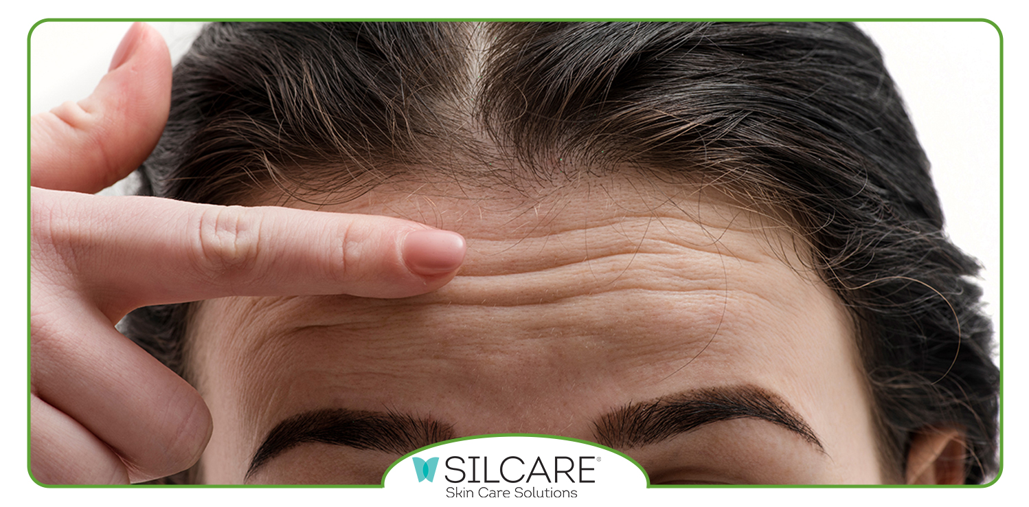 وازلین برای چروک پیشانی