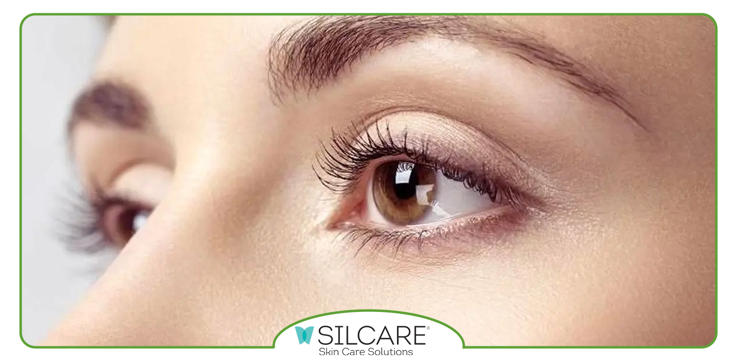 برای درمان خشکی دور چشم چه باید کرد؟