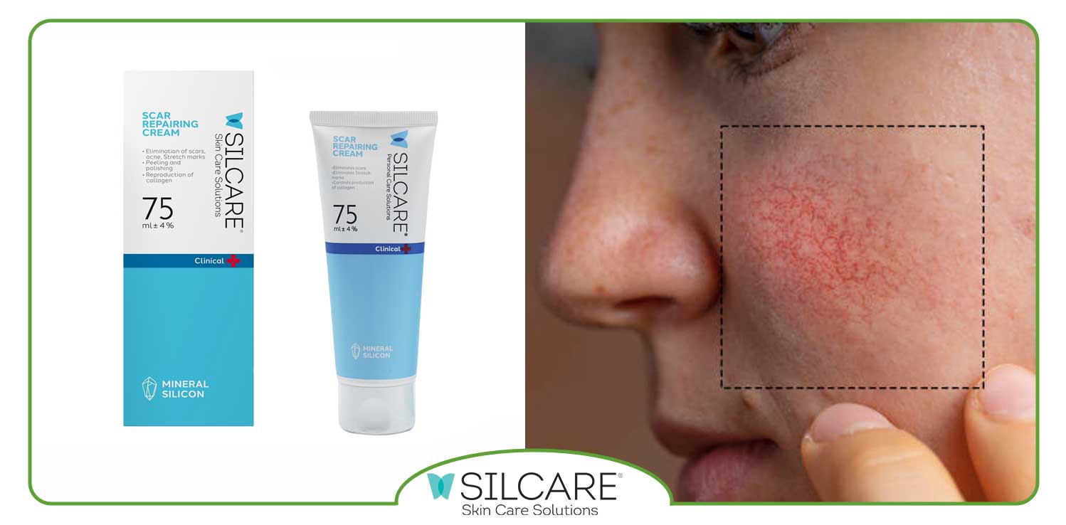 بهترین روتین پوستی برای کاهش قرمزی پوست چیست؟