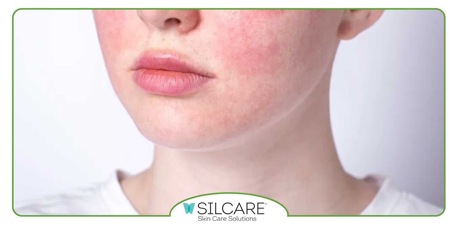 تغییرات سبک زندگی