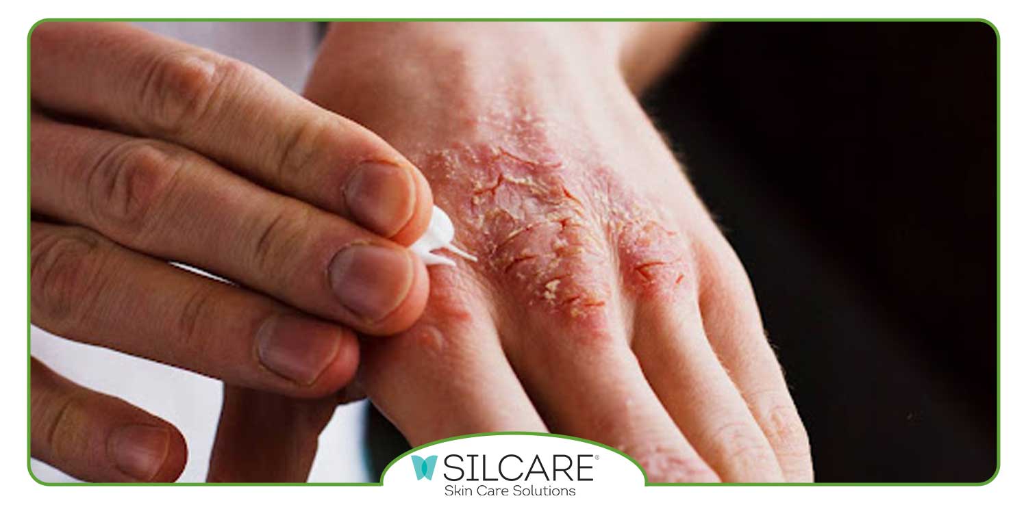 خشکی پوست بدن به چه دلیل اتفاق می افتد؟