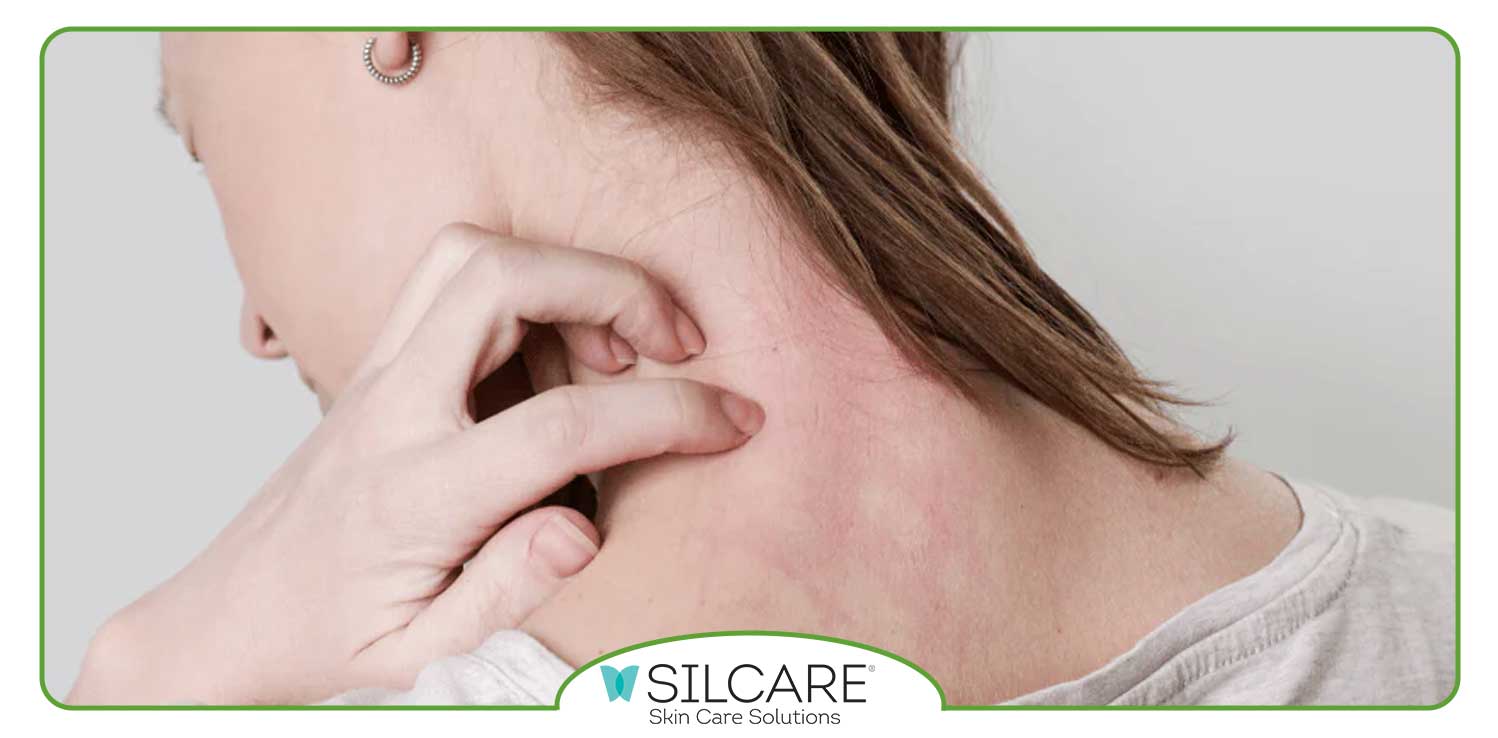 نحوه استفاده صحیح از کرم ترمیم کننده جای زخم سیلکر