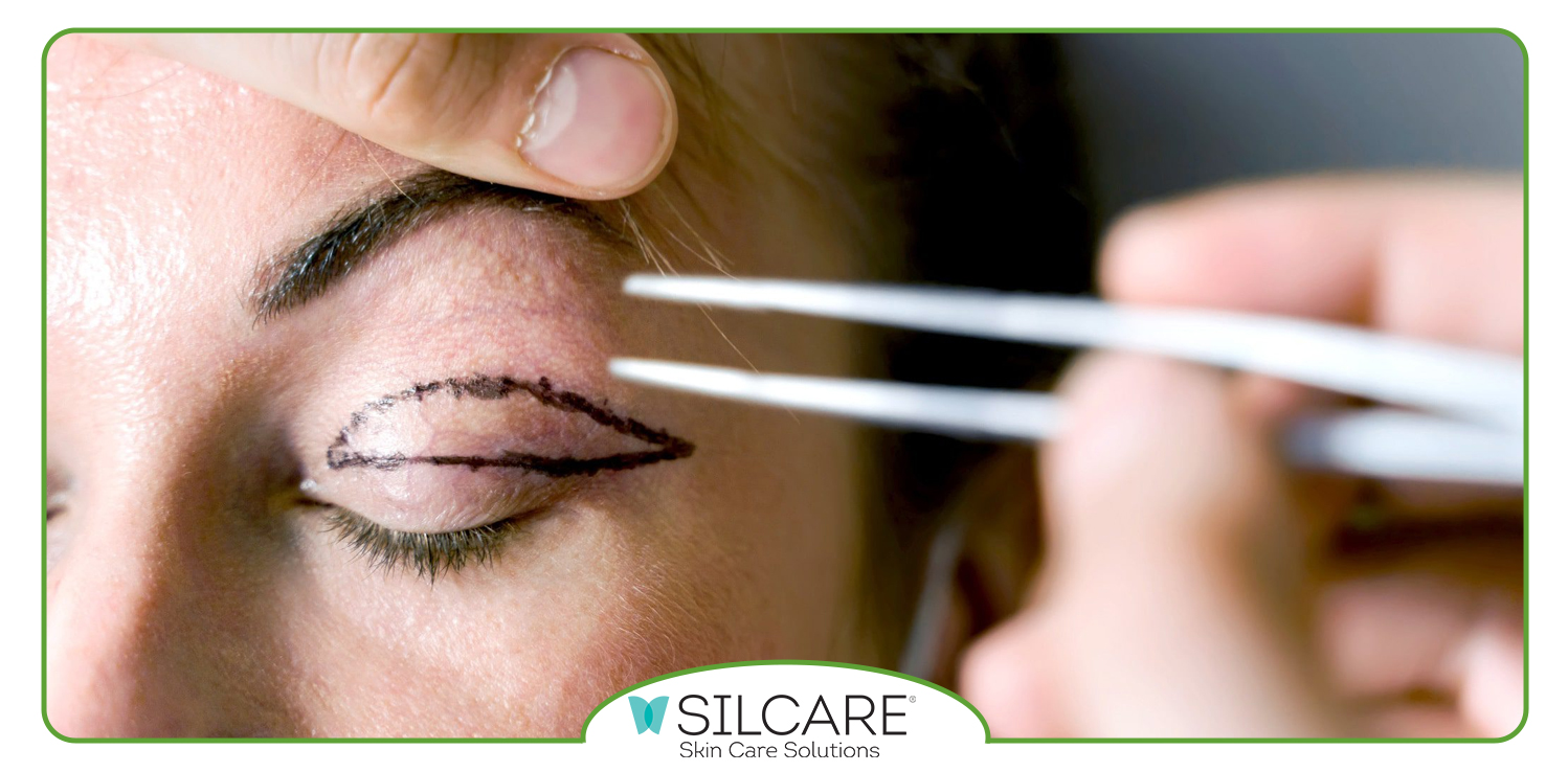 کرم ترمیم کننده بعد از بلفاروپلاستی