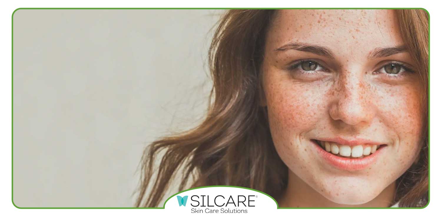 آیا ضد آفتاب برای کاهش و پیشگیری از کک و مک موثر است؟