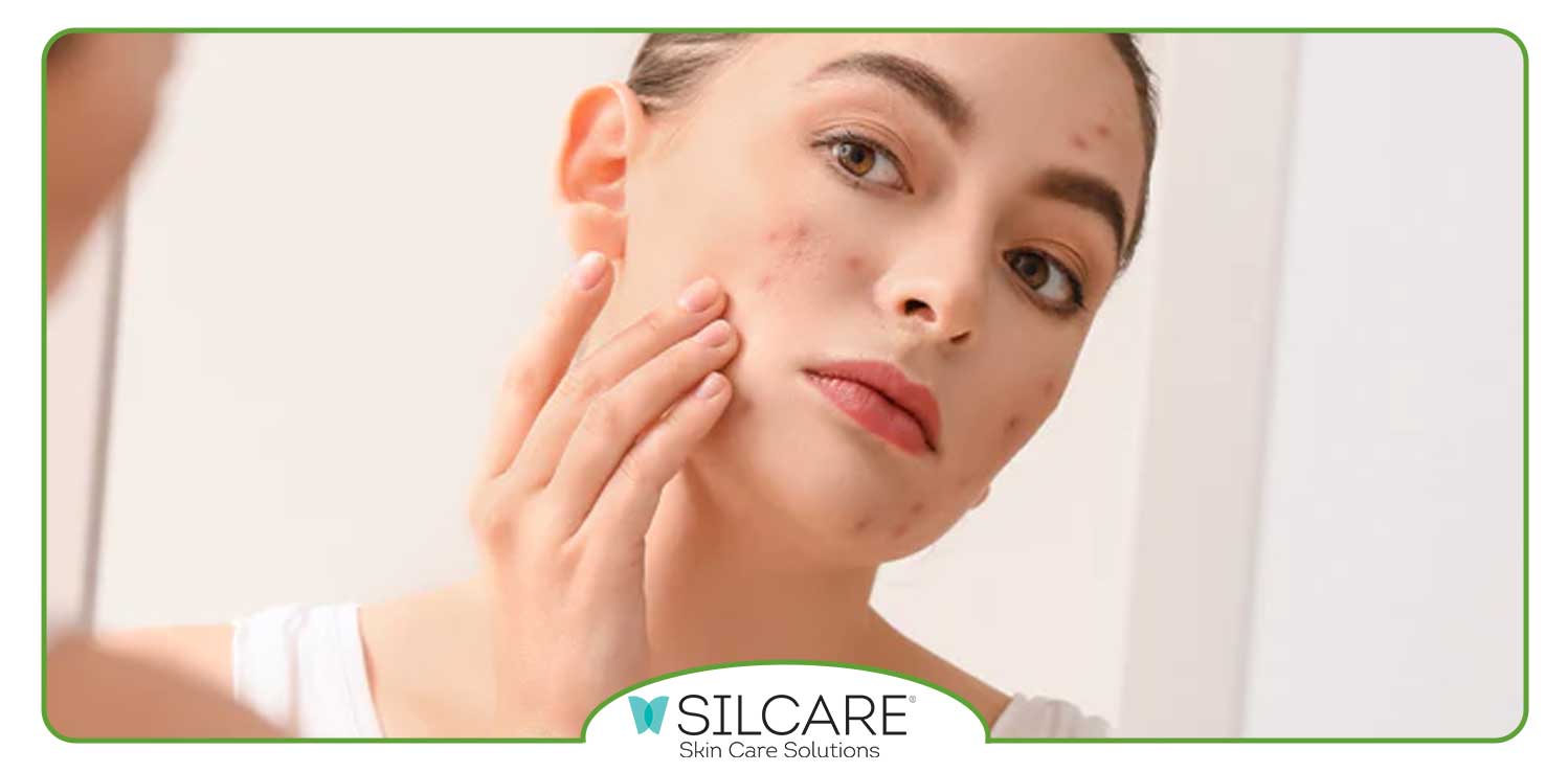 چگونه لک های صورت را از بین ببریم؟