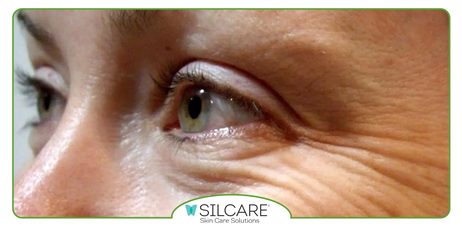 برند سیلکر ساخت کجاست؟