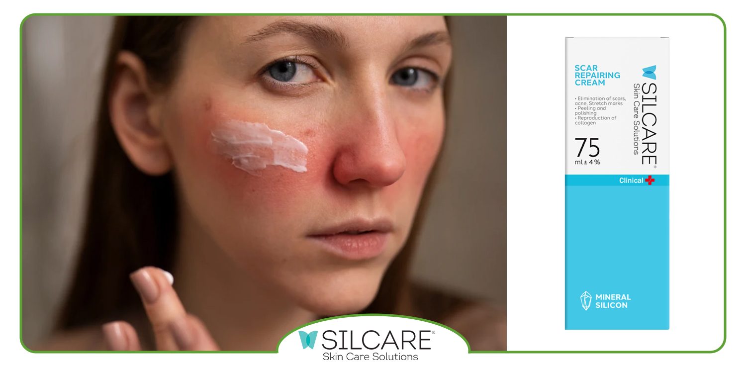 ویژگی های کرم ترمیم کننده خوب برای جای زخم و بخیه