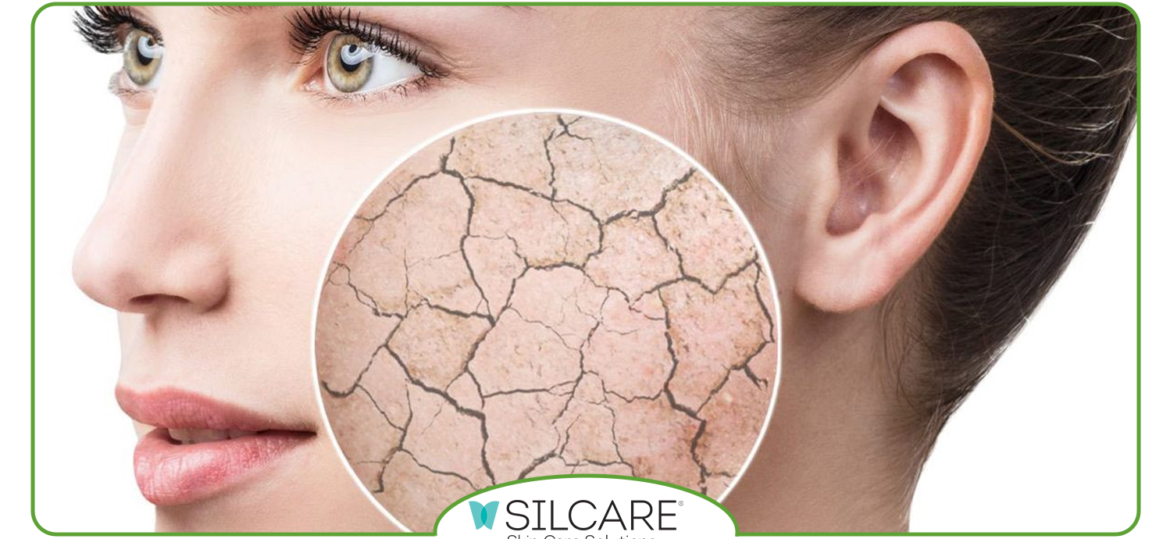 چرا تونر سیلکر مناسب‌ ترین انتخاب برای پوست ‌های خشک است؟ [ویژگی، مزایا، ترکیبات و نحوه استفاده از آن]