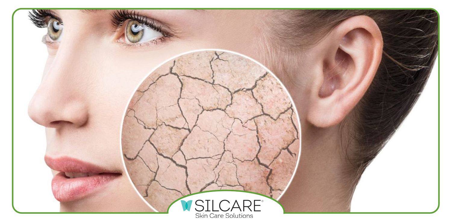 چرا تونر سیلکر مناسب‌ ترین انتخاب برای پوست ‌های خشک است؟ [ویژگی، مزایا، ترکیبات و نحوه استفاده از آن]