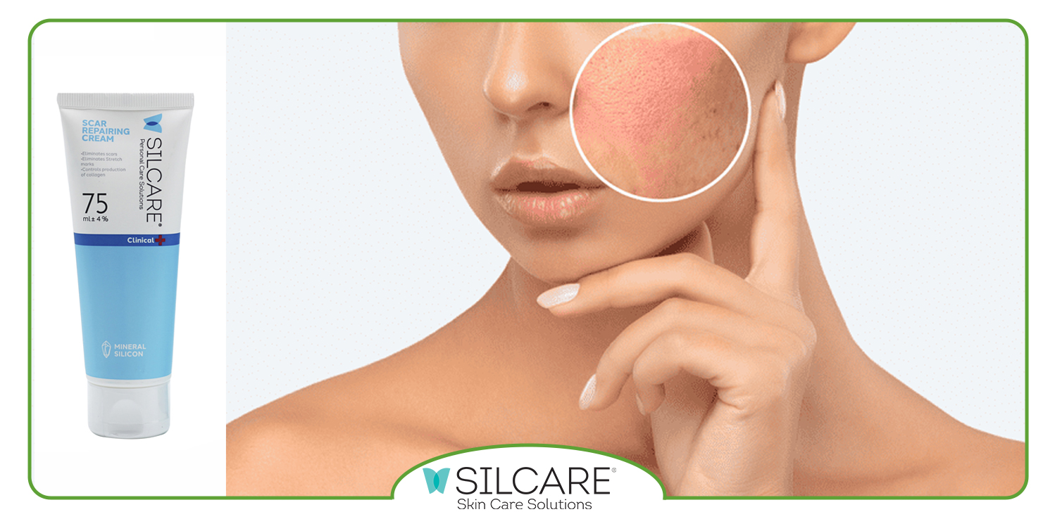 چه کرمی برای ترمیم زخم مناسب است؟