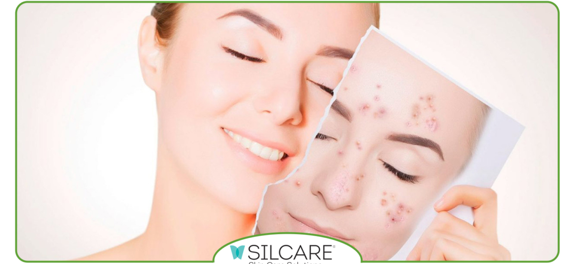 چگونه با سرم ضدلک سیلکر پوست شفاف تری داشته باشیم؟